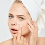 市販で買えるニキビ薬